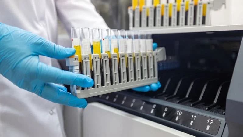 Новое оборудование ускорит исследования в ВИЧ‑лаборатории Надымской ЦРБ